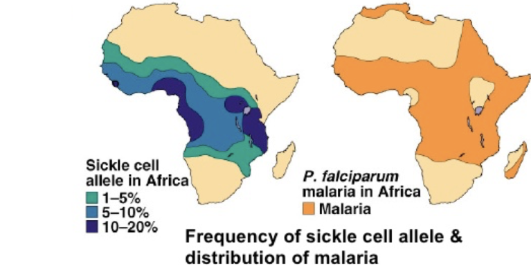 frequency of sickle cell