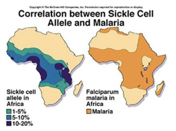 correlation sickle cell